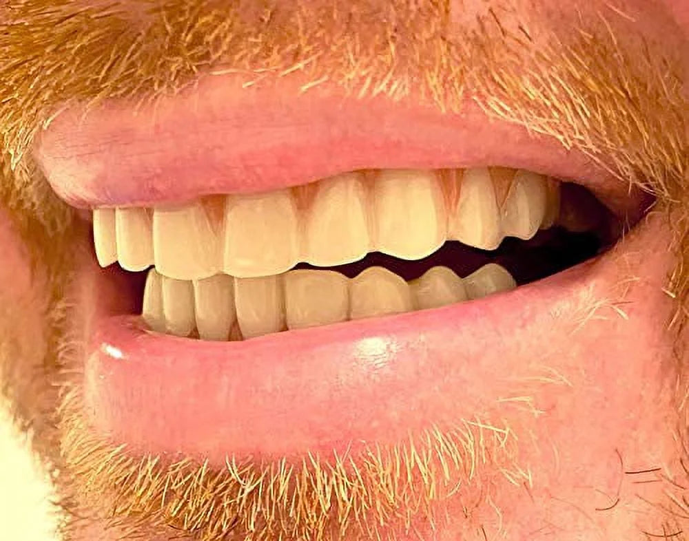 Instant Smile Comfort Fit Flex Teeth - Upper and Lower Matching Set, Natural Shade! Fix Your Smile at Home within Minutes!